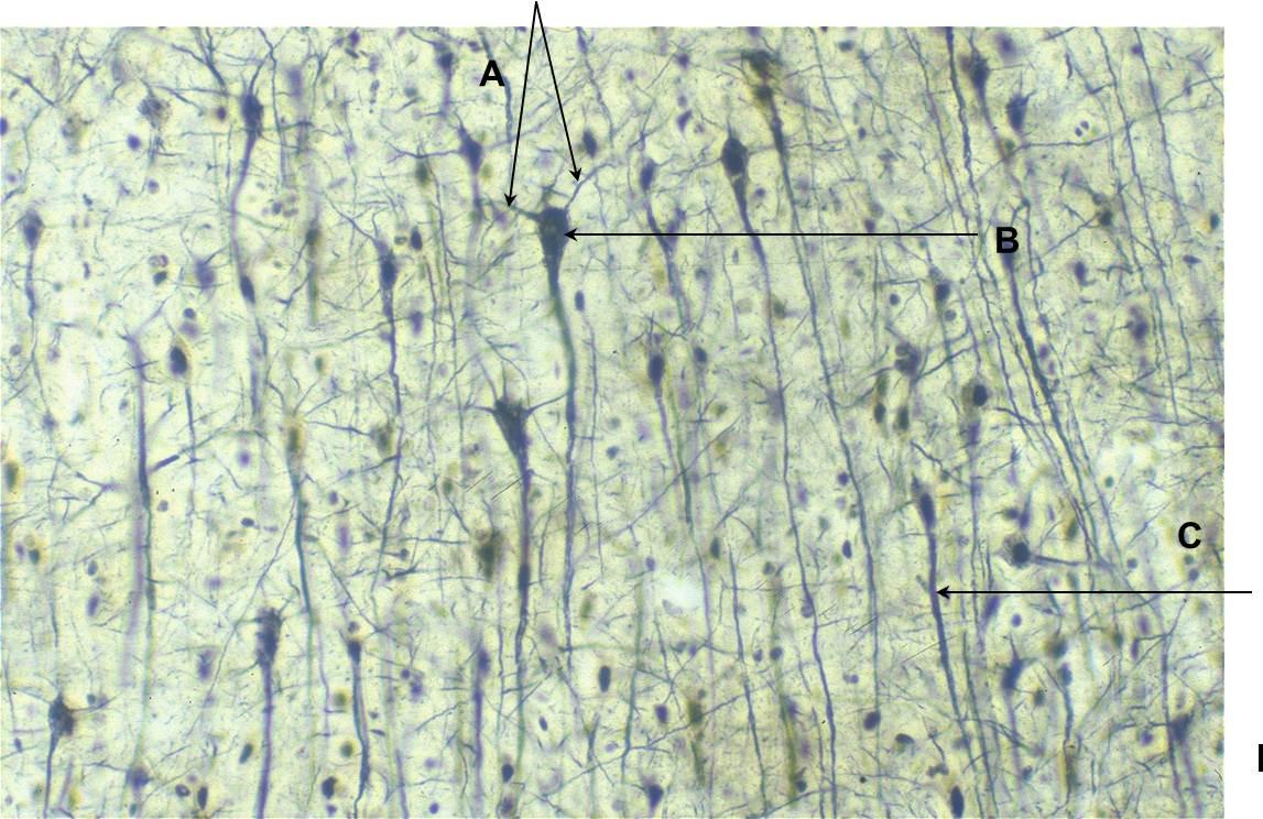 pyramidal_cell1326807253252.jpg