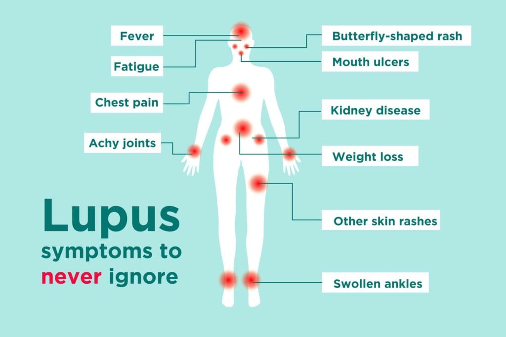 0219_Lupus-Symptoms-1024x683.jpg